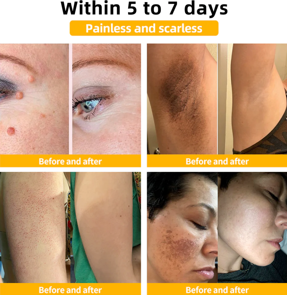 Bee Venom Treatment - Shopmixpro