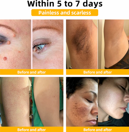 Bee Venom Treatment - Shopmixpro