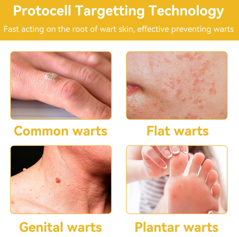Bee Venom Treatment - Shopmixpro