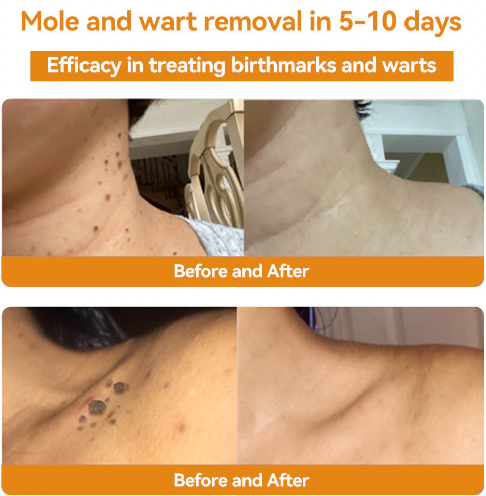 Bee Venom Treatment - Shopmixpro