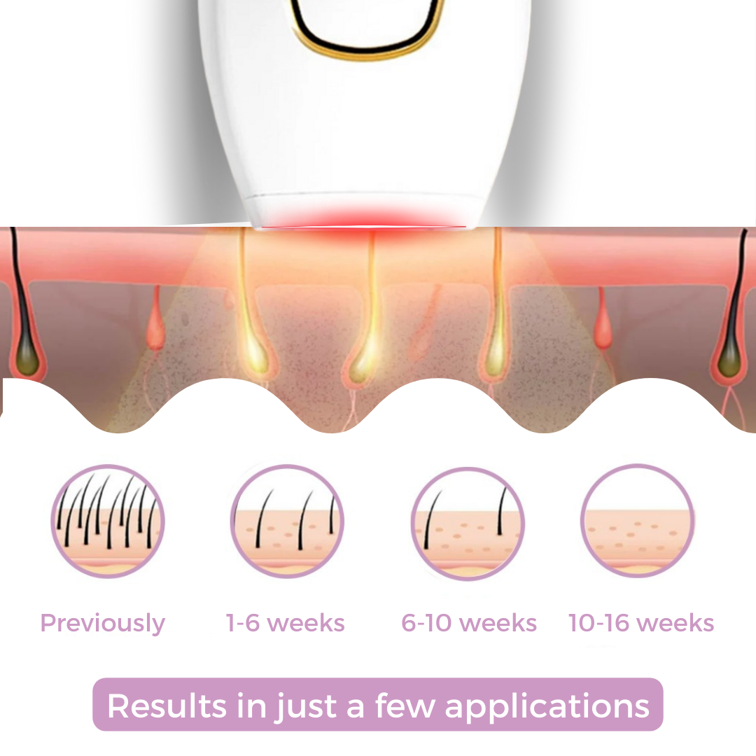 Mini Laser Hair Remover - Shopmixpro