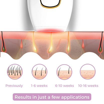 Mini Laser Hair Remover - Shopmixpro